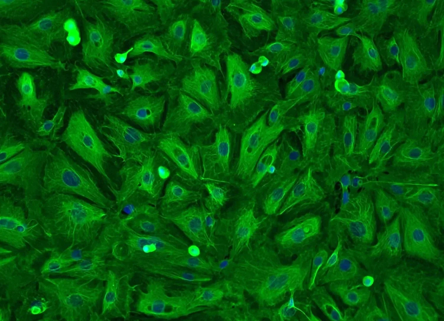 Células epiteliales alveolares humanas adultas.