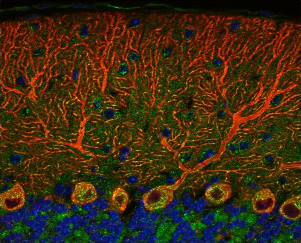 Mitocondrias (verde) en neuronas de Purkinje del cerebelo (rojo). Un estudio reciente mostró, en modelos experimentales, que recibir mitocondrias de neuronas puede favorecer la capacidad de las células cancerosas para formar metástasis.