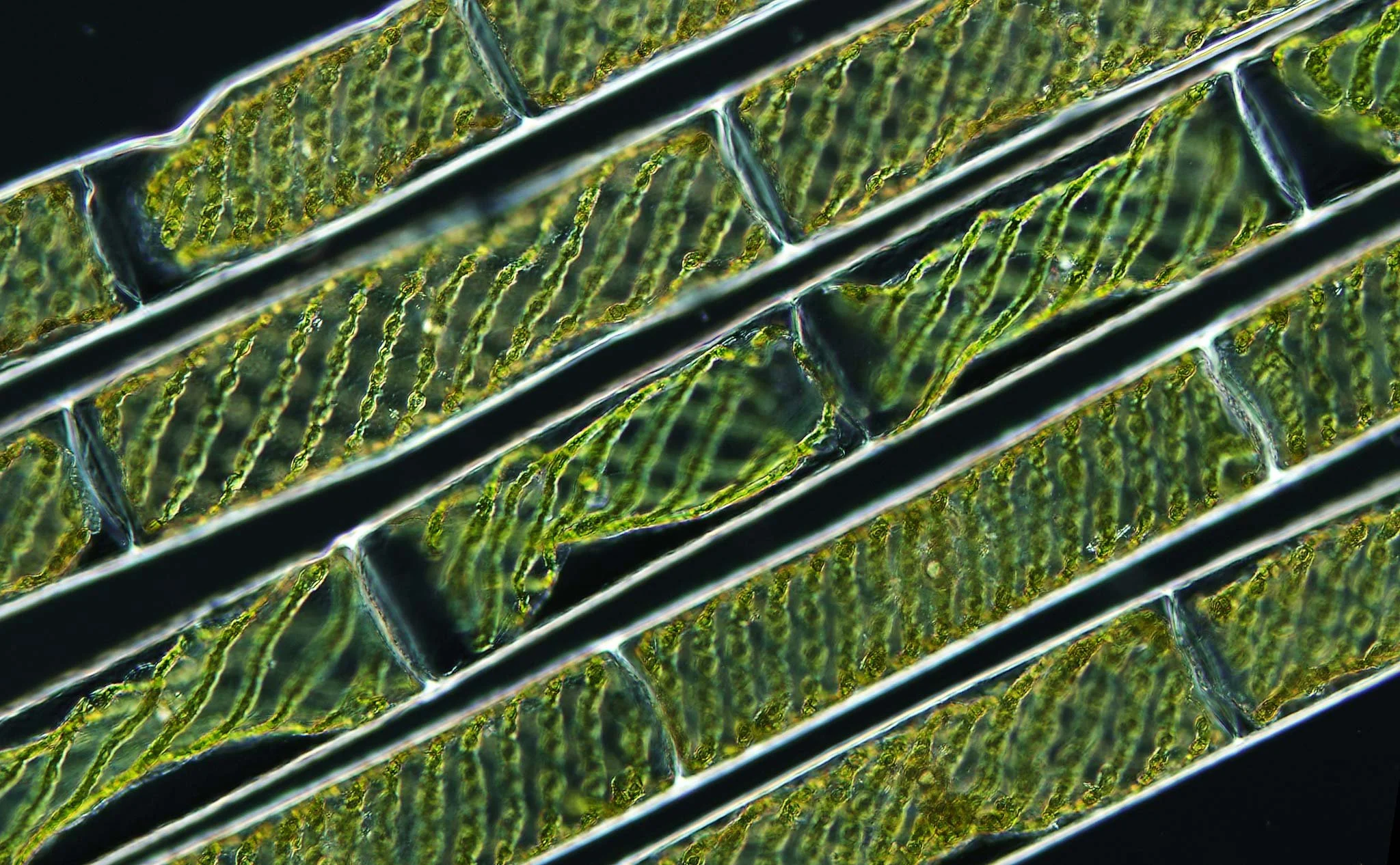 magen microscópica de Spirogyra, un alga verde filamentosa caracterizada por sus cloroplastos en espiral, las estructuras celulares responsables de realizar la fotosíntesis y transformar la luz en energía química