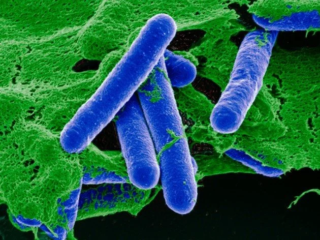 Micrografía electrónica coloreada de Clostridium botulinum