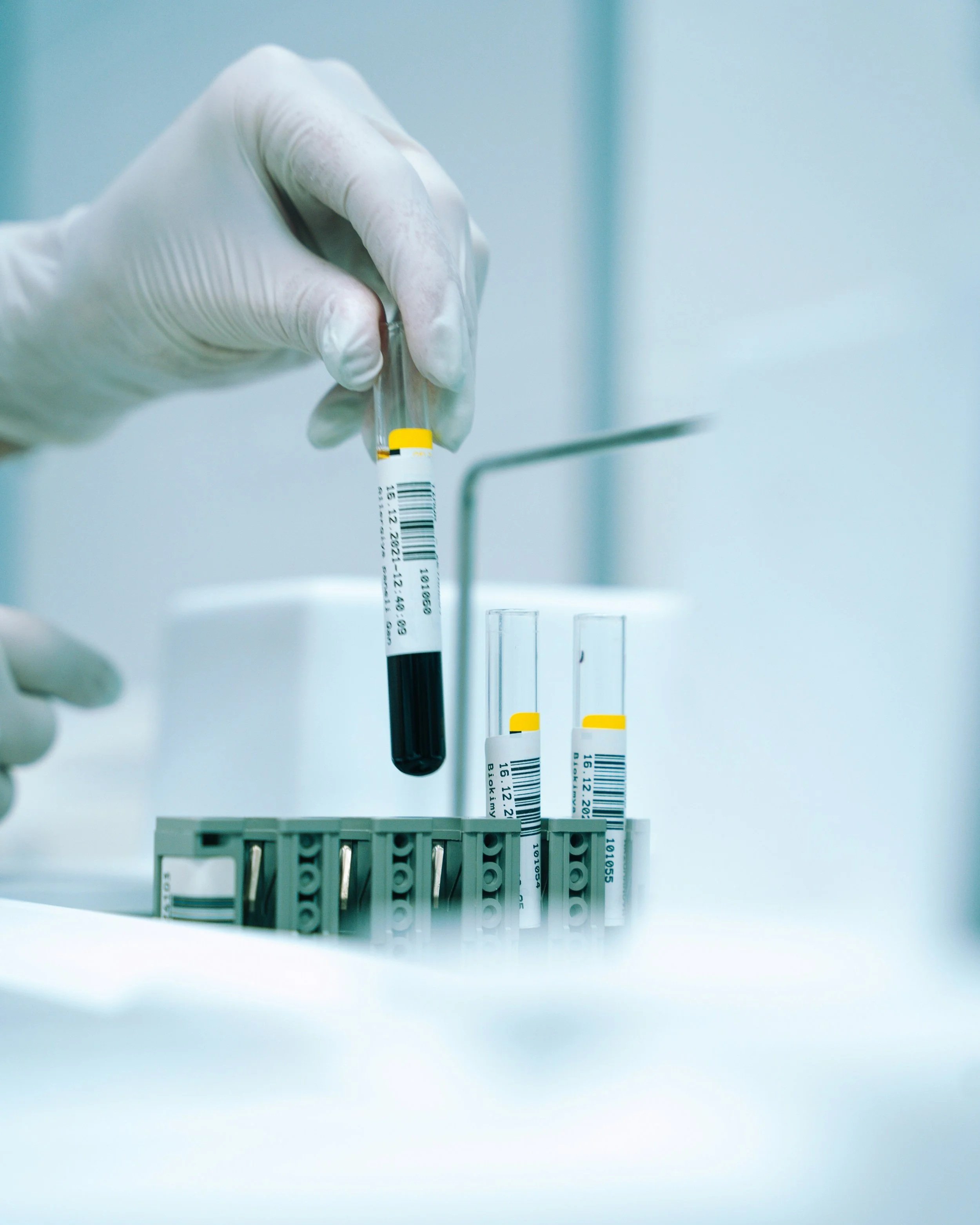 Un estudio publicado en JAMA Network Open muestra que el biomarcador p-tau217 en sangre puede predecir el riesgo de demencia hasta 25 años antes de los síntomas.