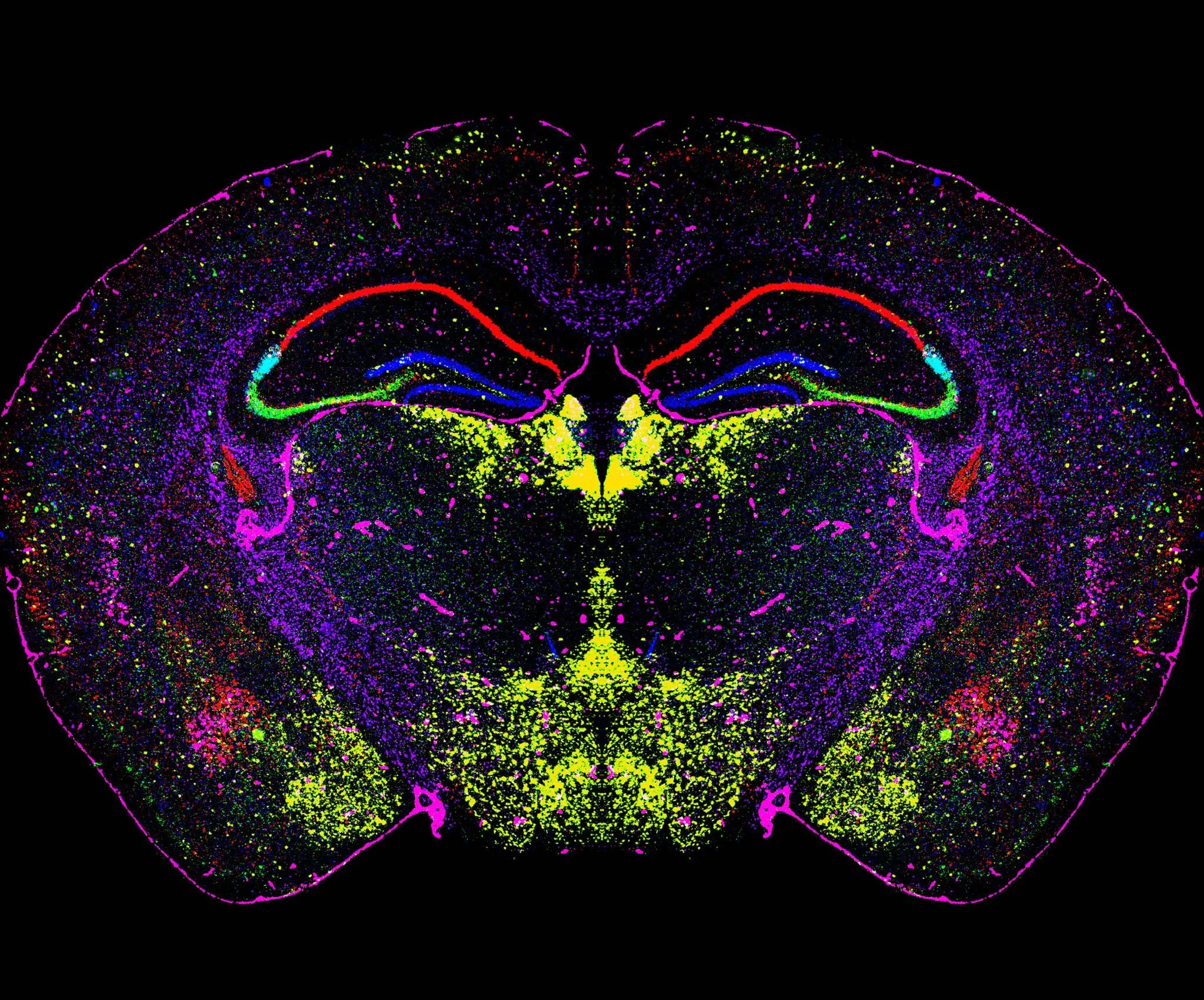 Corte coronal del cerebro de un ratón de diez semanas, con diferentes estructuras y poblaciones celulares señaladas mediante marcadores fluorescentes.