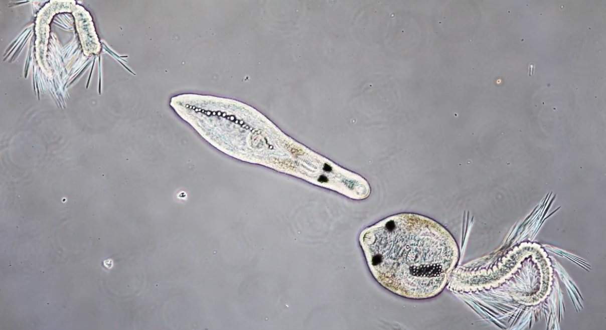 Dos larvas de gusanos planos parásitos (Platyhelminthes) observadas al microscopio.