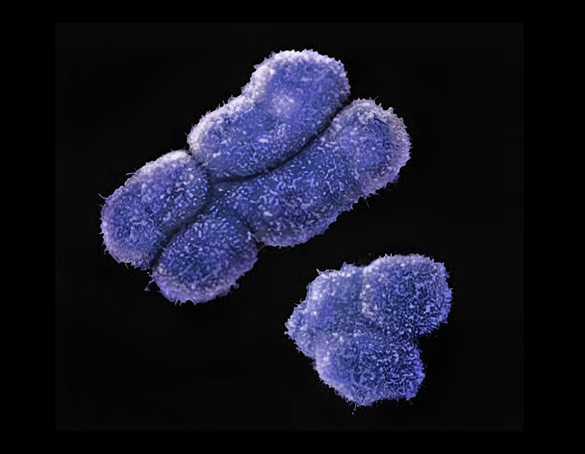 El cromosoma Y humano (derecha) es más pequeño que el cromosoma X (izquierda), pero contiene genes relevantes para la regulación celular, la estabilidad del genoma y la respuesta inmunitaria.