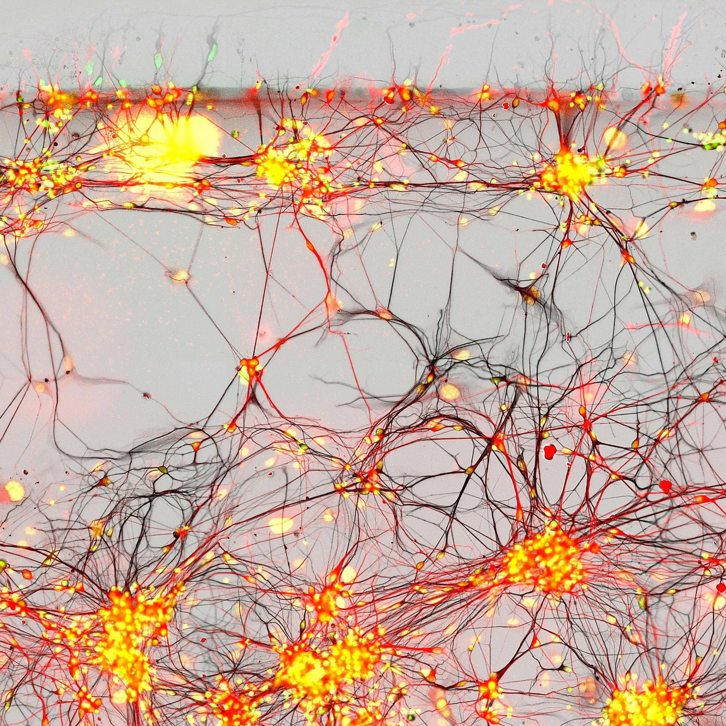 Red de neuronas humanas cultivadas en laboratorio a partir de células de pacientes con párkinson. Su estudio podría ayudar a comprender los mecanismos de supervivencia y degeneración neuronal.