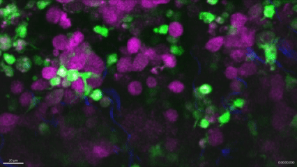 Vídeo de microscopía intravital que muestra a un macrófago —en verde— engullendo una célula de melanoma —en magenta— en tiempo real,