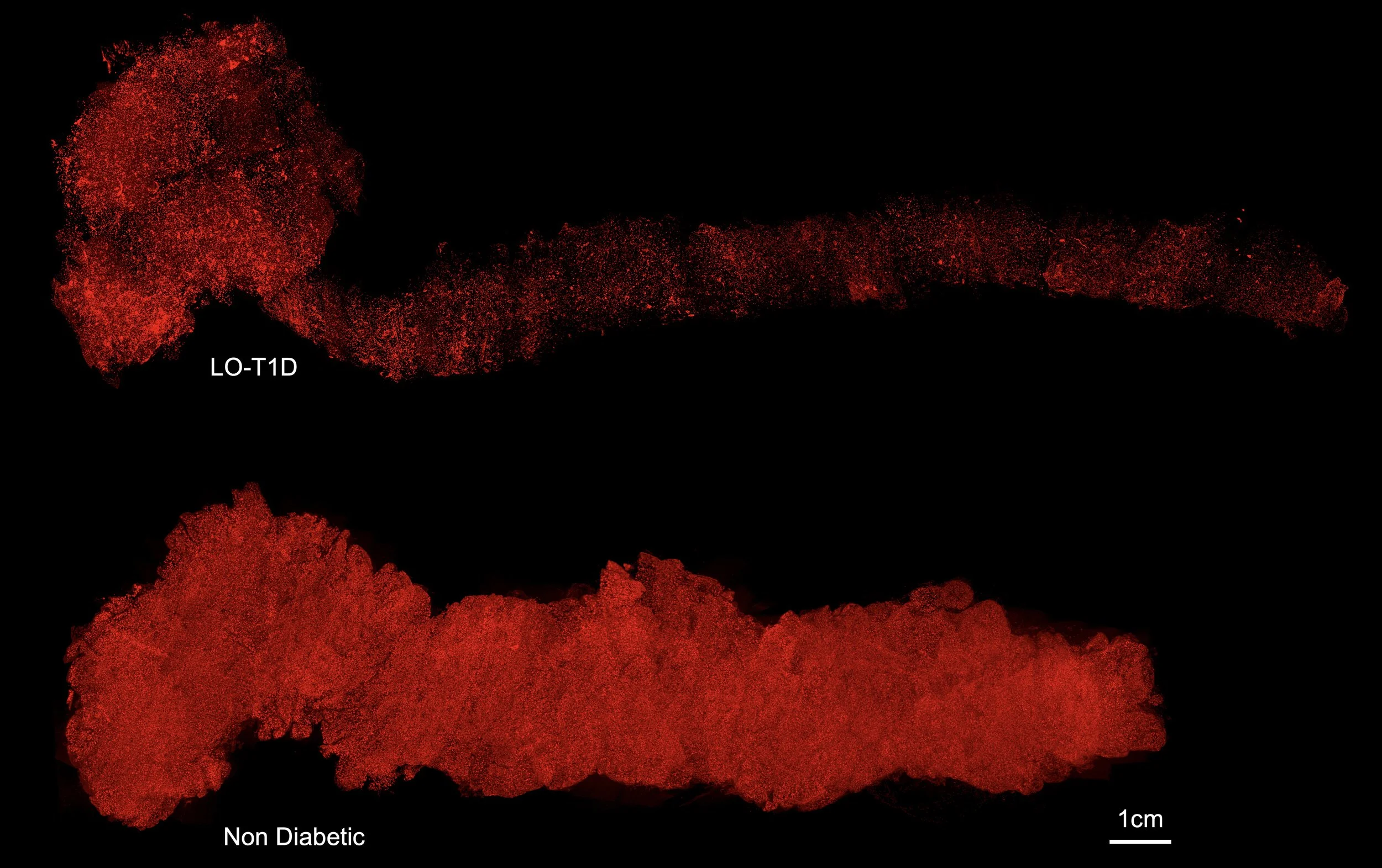 Reconstrucción tridimensional completa de dos páncreas humanos en los que los islotes de Langerhans aparecen teñidos de rojo para identificar las células productoras de insulina.