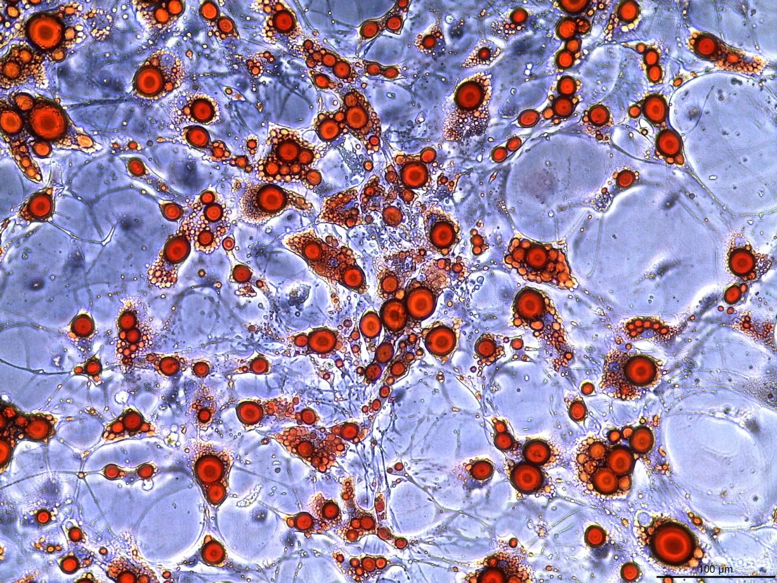 En el nuevo trabajo, los investigadores comprobaron que adipocitos —arriba— expuestos al plasma obtenido después de los esprints modificaron profundamente su actividad genética