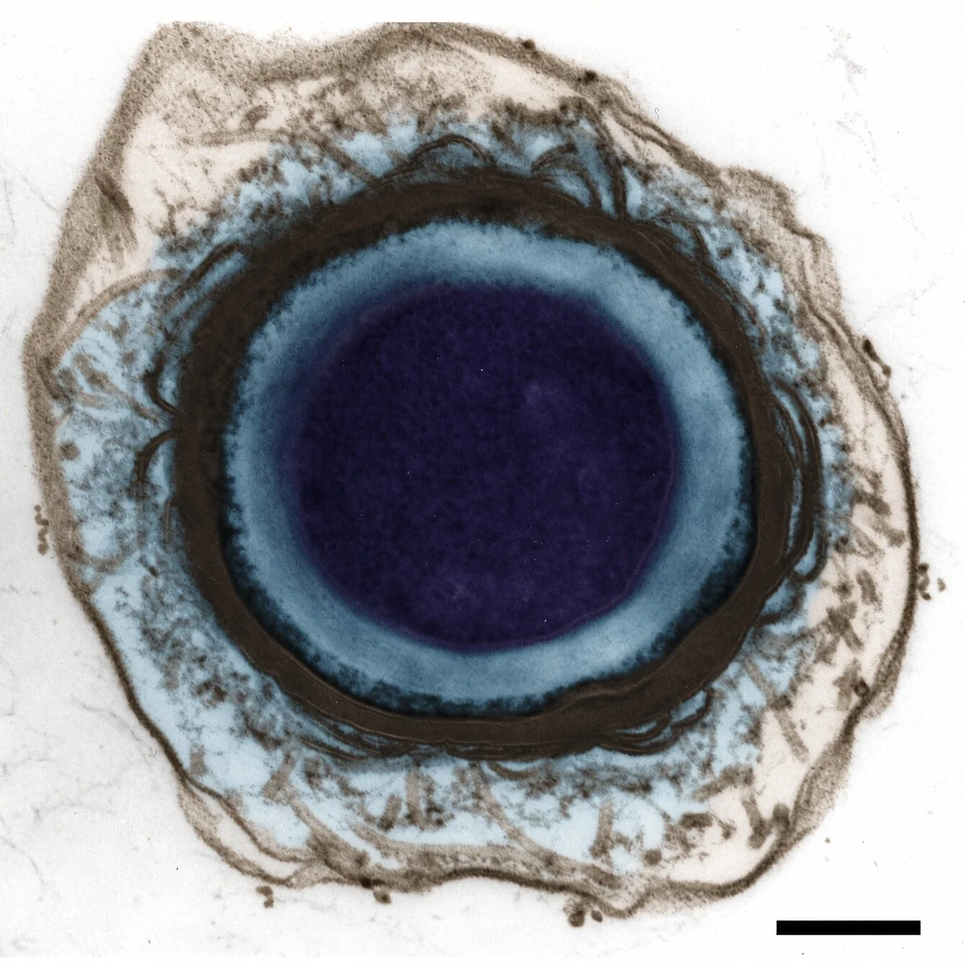 Imagen de microscopía electrónica de una espora de Clostridium botulinum.