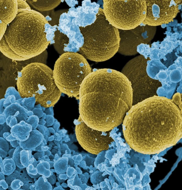 Micrografía electrónica coloreada de Staphylococcus aureus —en amarillo— escapando de la destrucción por glóbulos blancos humanos.