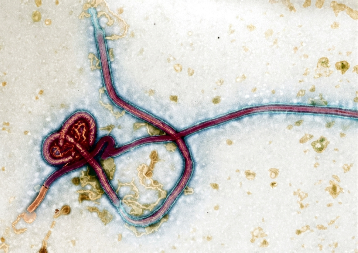 Virus del ébola.