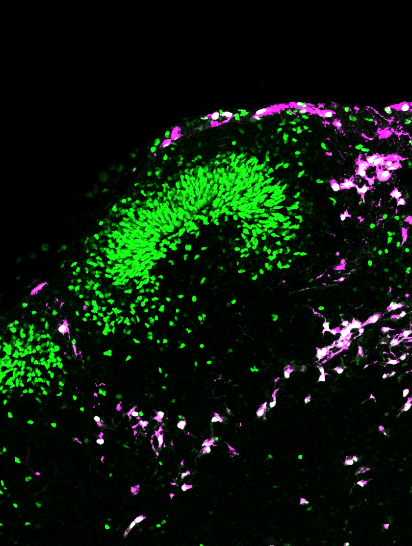 Organoide cerebral cultivado a partir de células madre humanas.