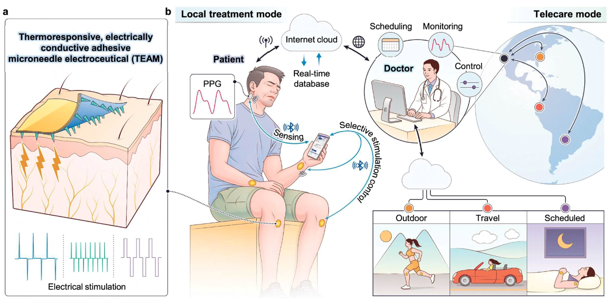 Esquema del parche electrocéutico de microagujas y su sistema inalámbrico para controlar y personalizar a distancia el tratamiento del dolor.