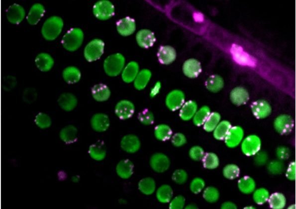 En esta imagen de microscopía, los núcleos aparecen en verde y los centrómeros en magenta, mostrando su distribución desigual en el interior de las células.