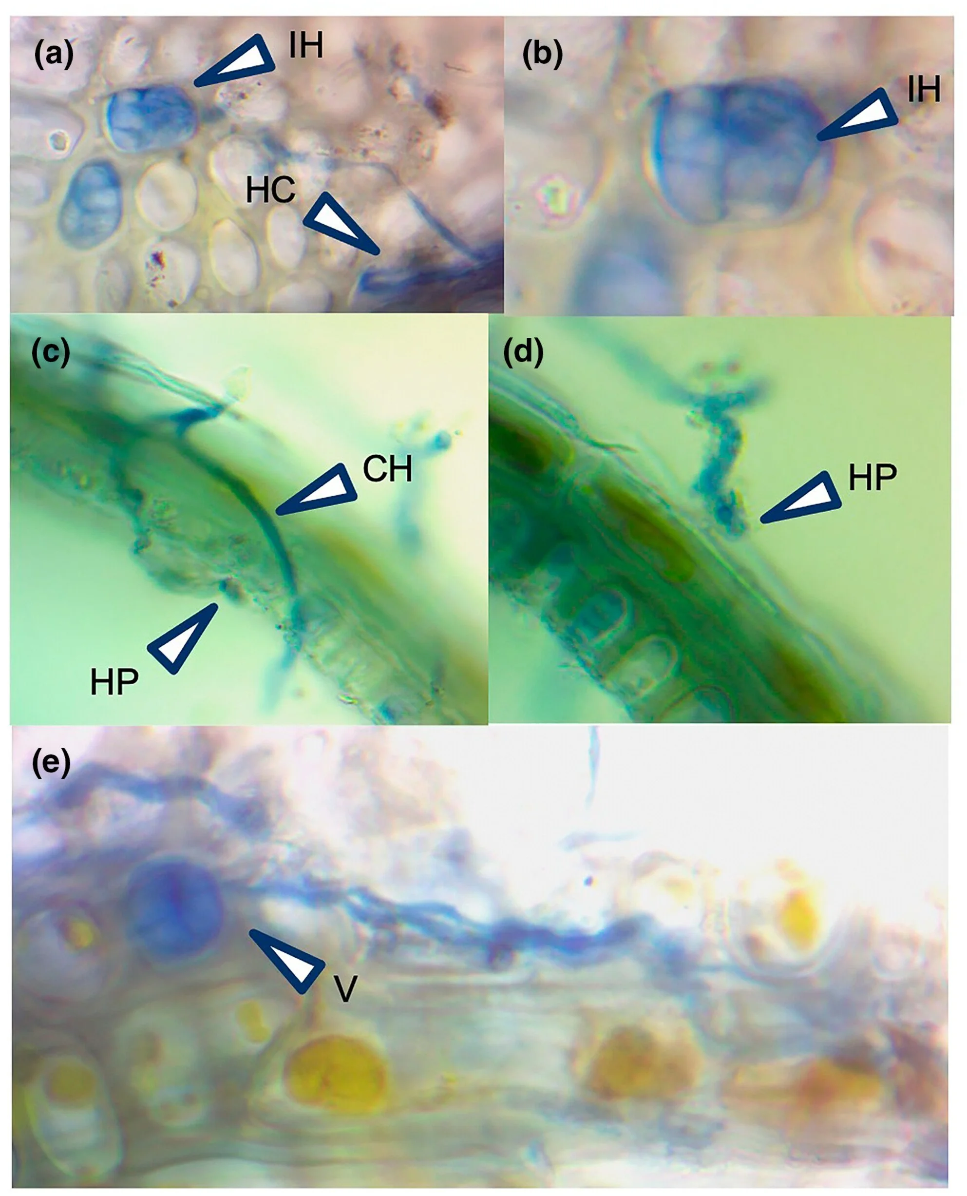 Los investigadores identificaron hifas, ramificaciones intracelulares, vesículas de almacenamiento y otras formaciones características de los hongos Glomeromycotina.