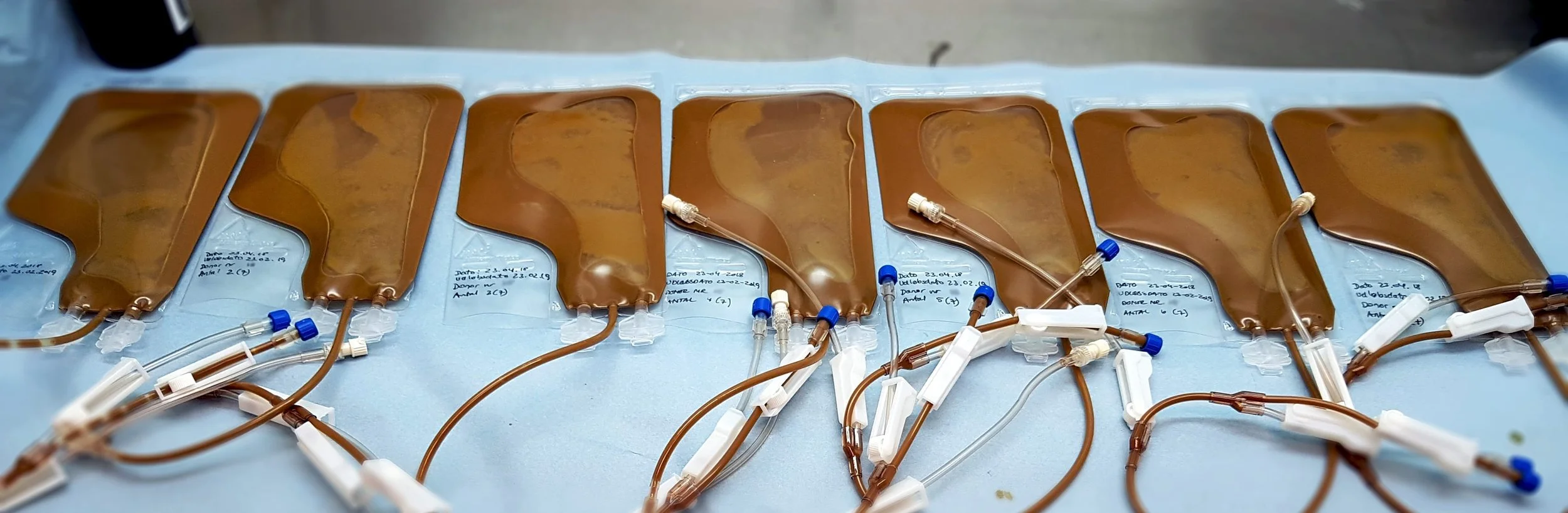 Un ensayo clínico muestra que el trasplante de microbiota fecal puede reforzar la eficacia de la inmunoterapia contra el cáncer. La técnica, aún experimental, ha logrado prolongar el control de la enfermedad en pacientes con cáncer renal avanzado.