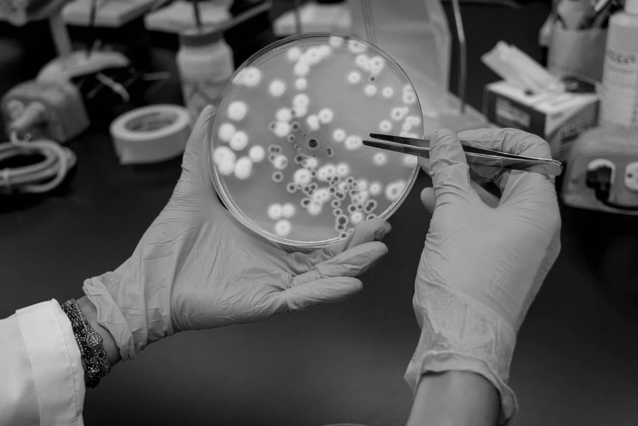 El análisis del microbioma intestinal revela desequilibrios bacterianos —o disbiosis— vinculados a procesos de inflamación que podrían influir en el desarrollo del alzhéimer.