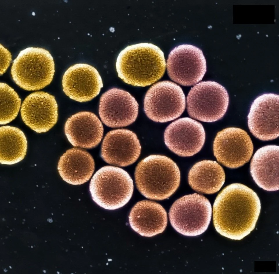 Imagen microscópica coloreada de las nanopartículas sensibles al sonido desarrolladas por el equipo de Andrew Goodwin, capaces de vibrar con ultrasonidos y ablandar el tejido tumoral, facilitando la acción de la quimioterapia.