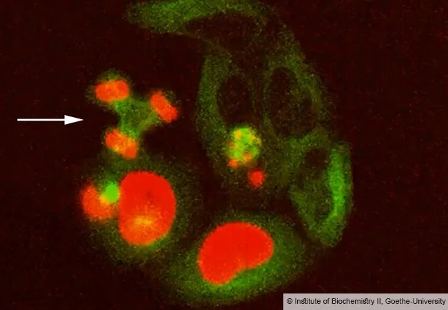 El fallo de la enzima de reparación SPRTN en estas células en cultivo provoca errores letales en la división celular, como la distribución incorrecta de los cromosomas.
