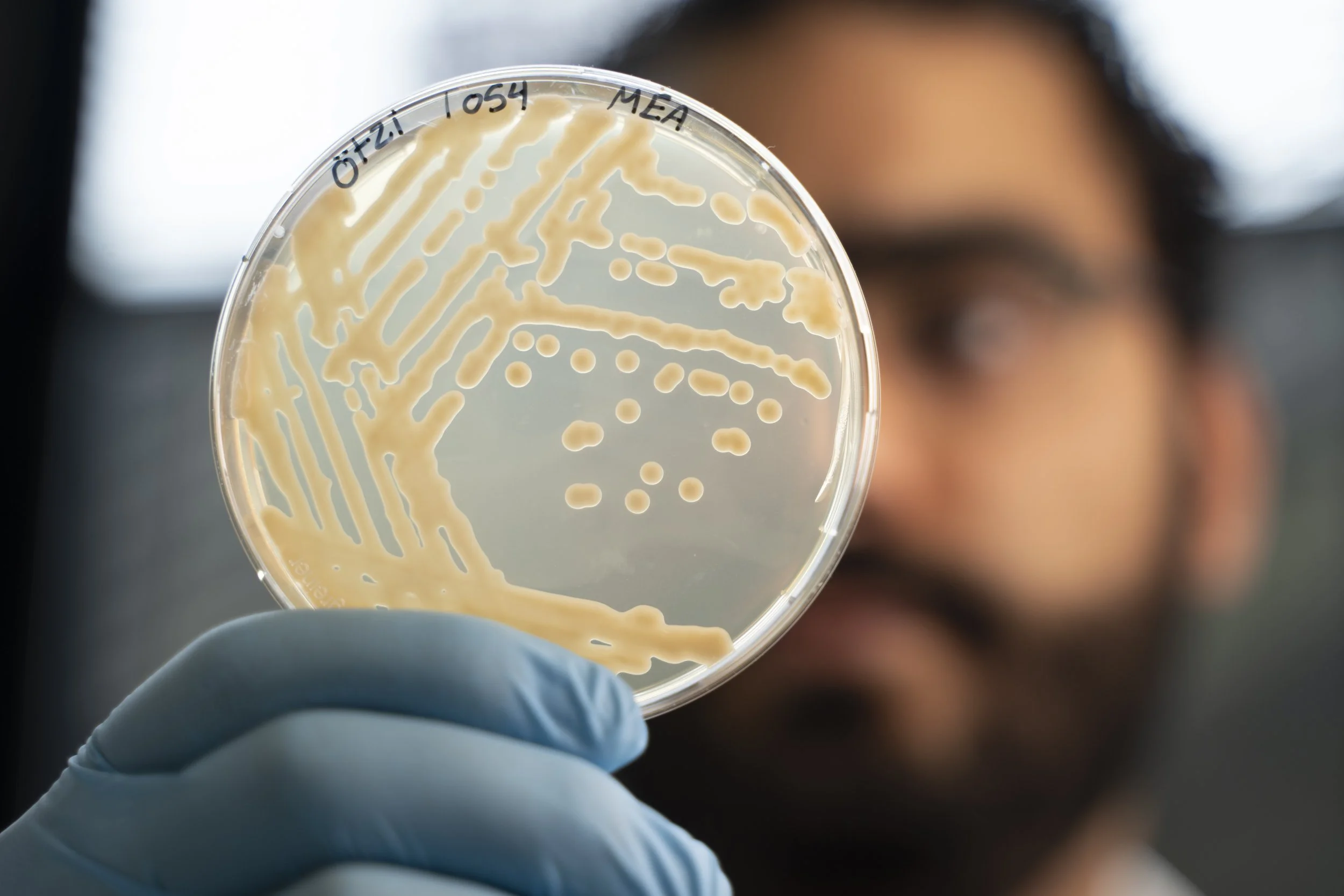 El microbiólogo Mohamed Sarhan observa colonias de levaduras cultivadas a partir de muestras extraídas del estómago de Ötzi.
