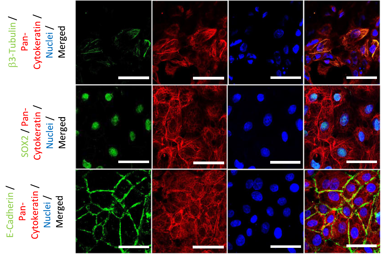Células humanas tras diez días de diferenciación hacia el ectodermo superficial, una etapa inicial para obtener organoides salivales. Las tinciones fluorescentes identifican distintas proteínas celulares y los núcleos, en azul.