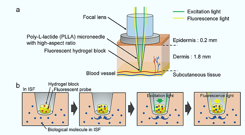 Microaguja óptica de PLLA con un hidrogel fluorescente en la punta.