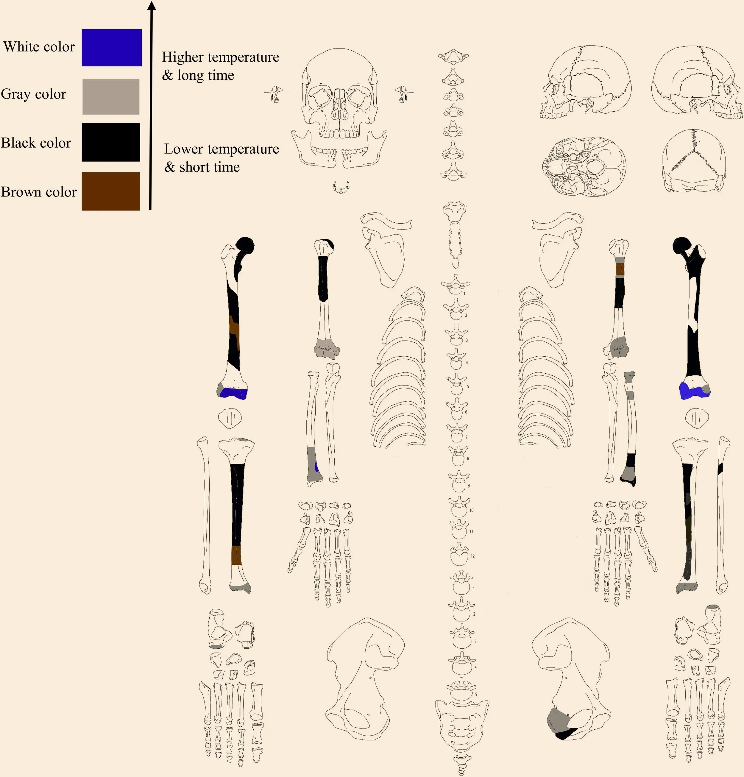 Inventario esquelético y alteraciones térmicas de los restos humanos, que muestran cómo el color de los huesos varía según la temperatura y la exposición directa al fuego durante la cremación.