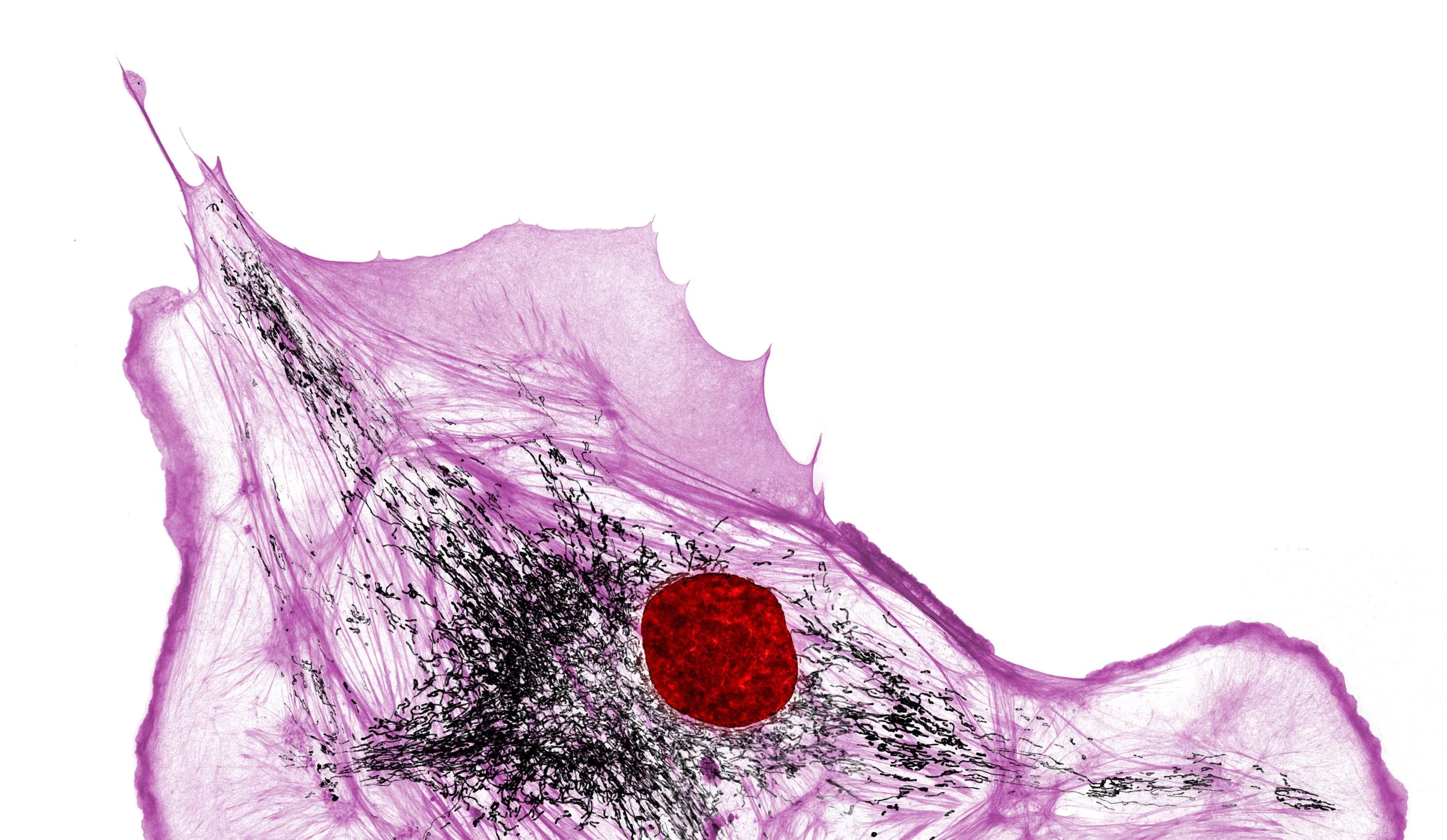 Imagen microscópica de una célula endotelial en la que se distinguen la actina (rosa), el ADN (rojo) y las mitocondrias (negro).