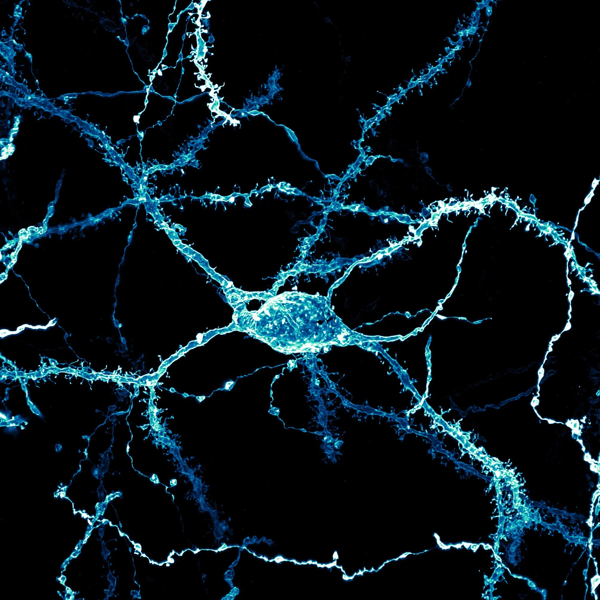 Neurona del cuerpo estriado de una rata adulta, cuyas dendritas aparecen densamente cubiertas de espinas, pequeñas prolongaciones que reciben señales de otras células nerviosas.
