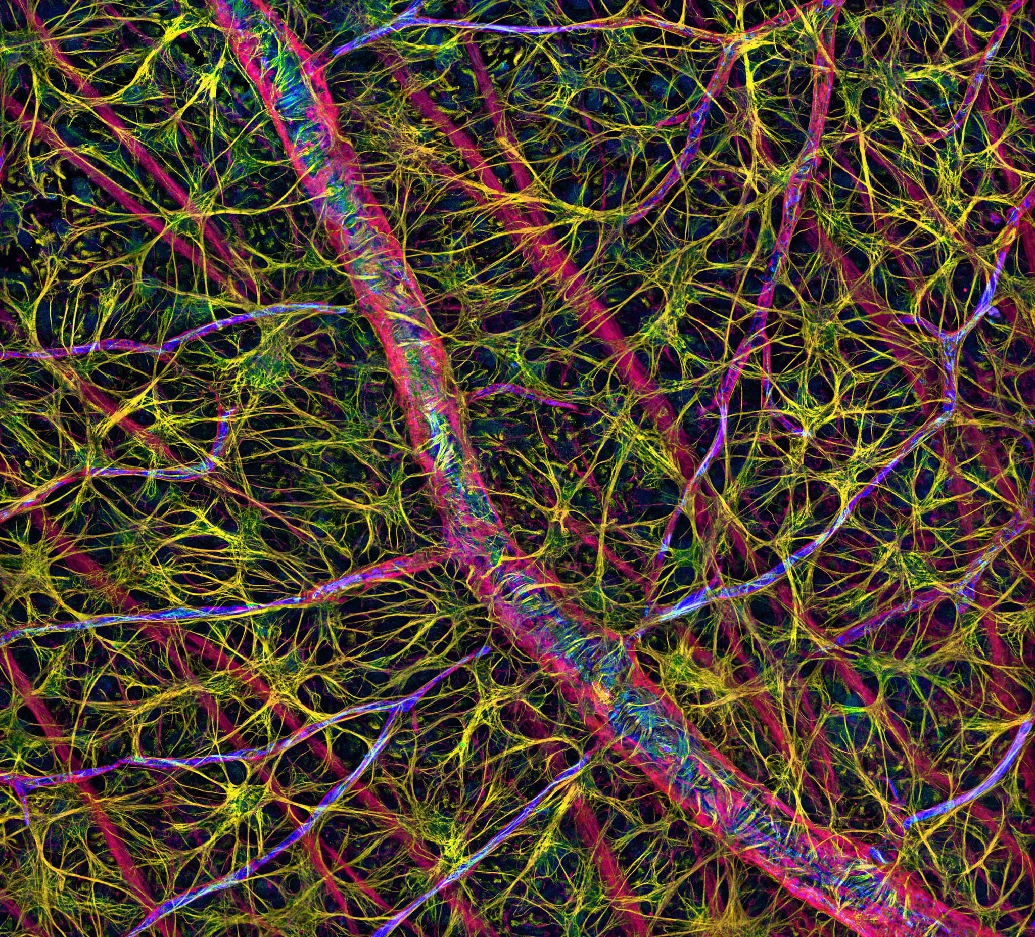 Imagen microscópica de la retina de una rata en la que se aprecia la estrecha relación entre los astrocitos, células gliales con numerosas prolongaciones, y la compleja red de vasos sanguíneos que recorre el tejido