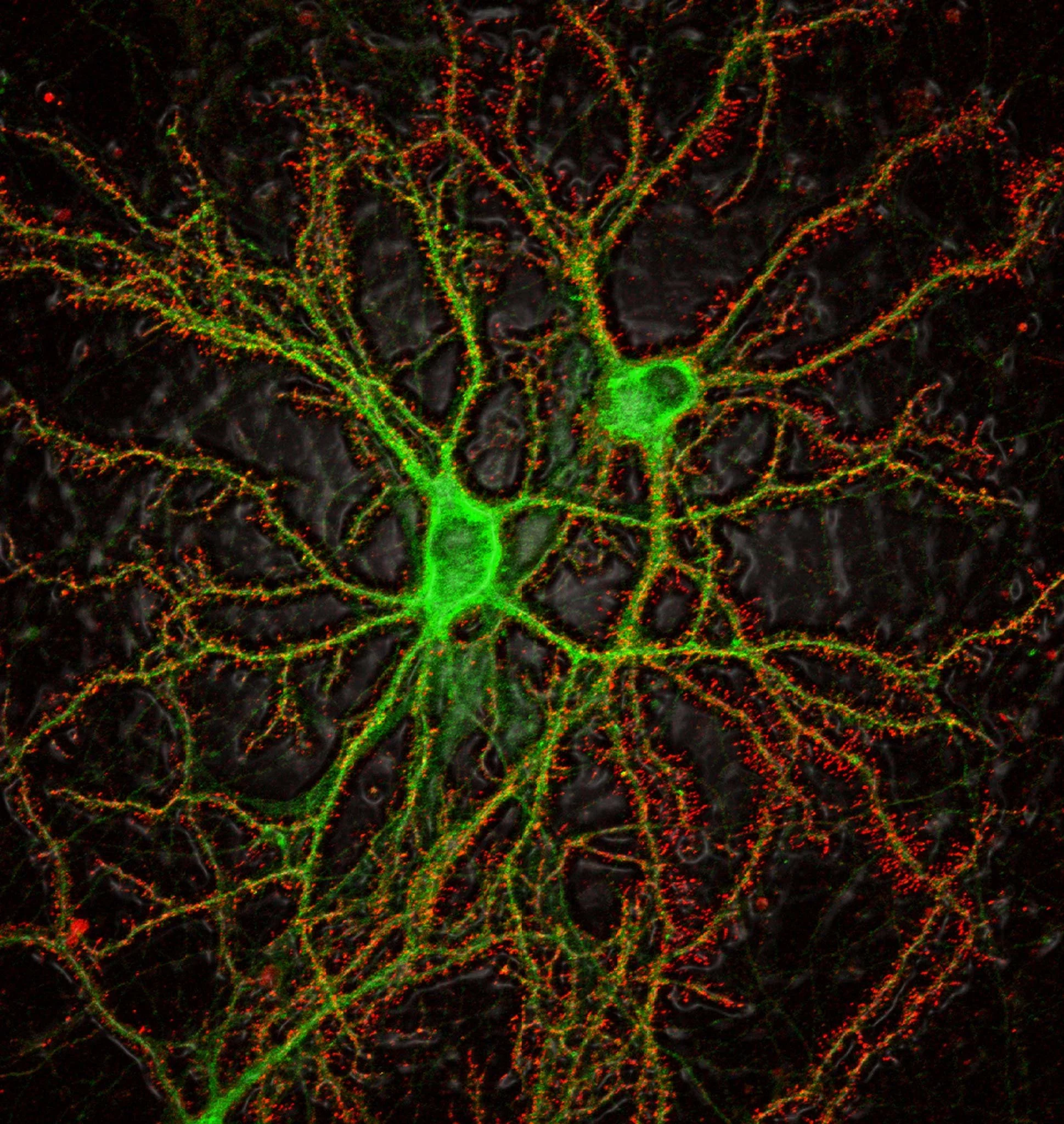 Micrografía de neuronas del hipocampo de rata expuestas a neurotoxinas asociadas al alzhéimer. Estas sustancias favorecen la acumulación de proteínas tóxicas y desencadenan procesos de degeneración neuronal, como la carioptosis.
