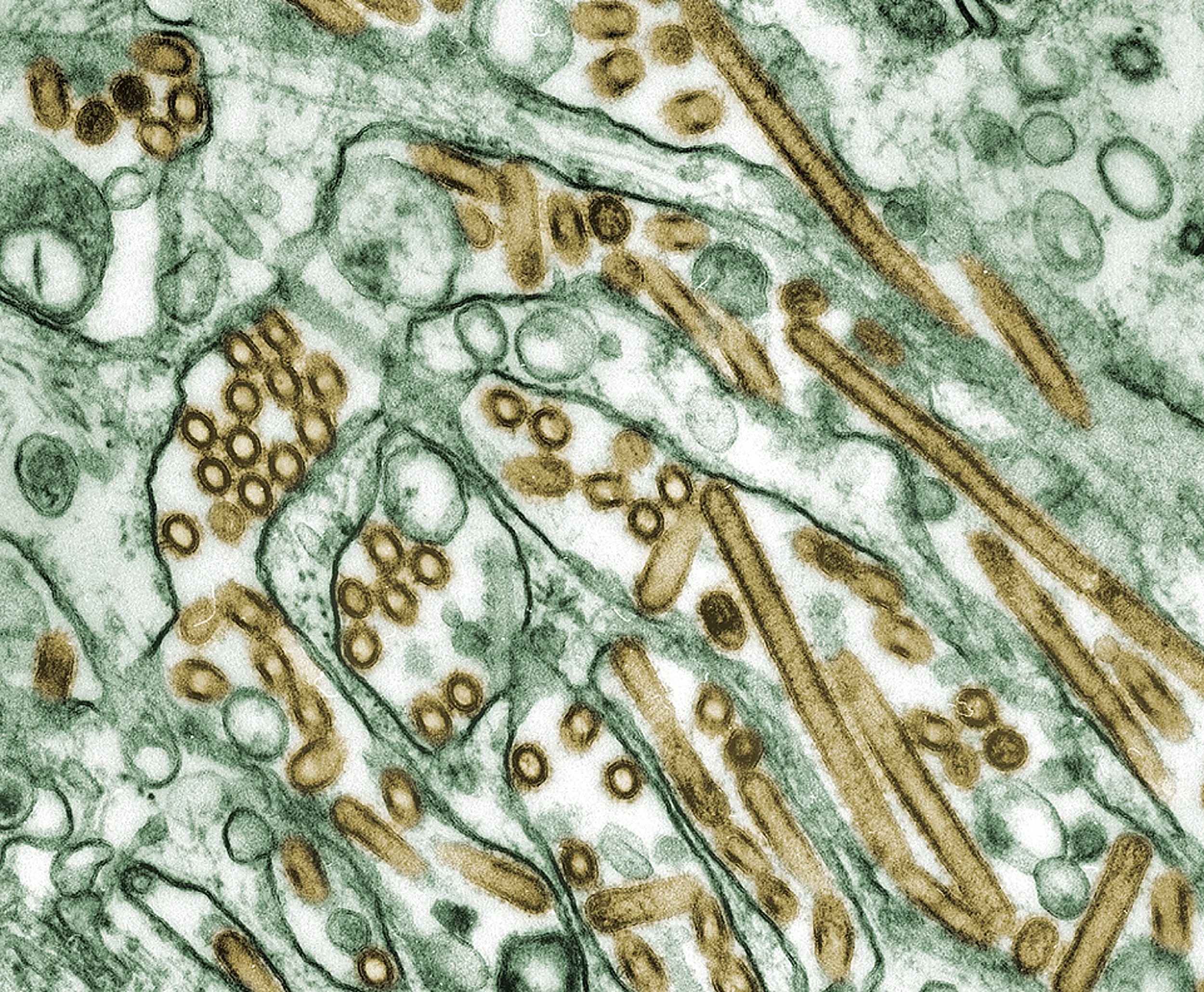 Micrografía electrónica coloreada del virus de la gripe aviar A(H5N1) (en dorado) multiplicándose en células MDCK, un modelo ampliamente utilizado para estudiar la infección por virus influenza.
