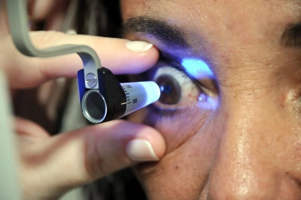 Tonometría con tonómetro Goldmann, para medir la presión intraocular en pacientes con glaucoma.