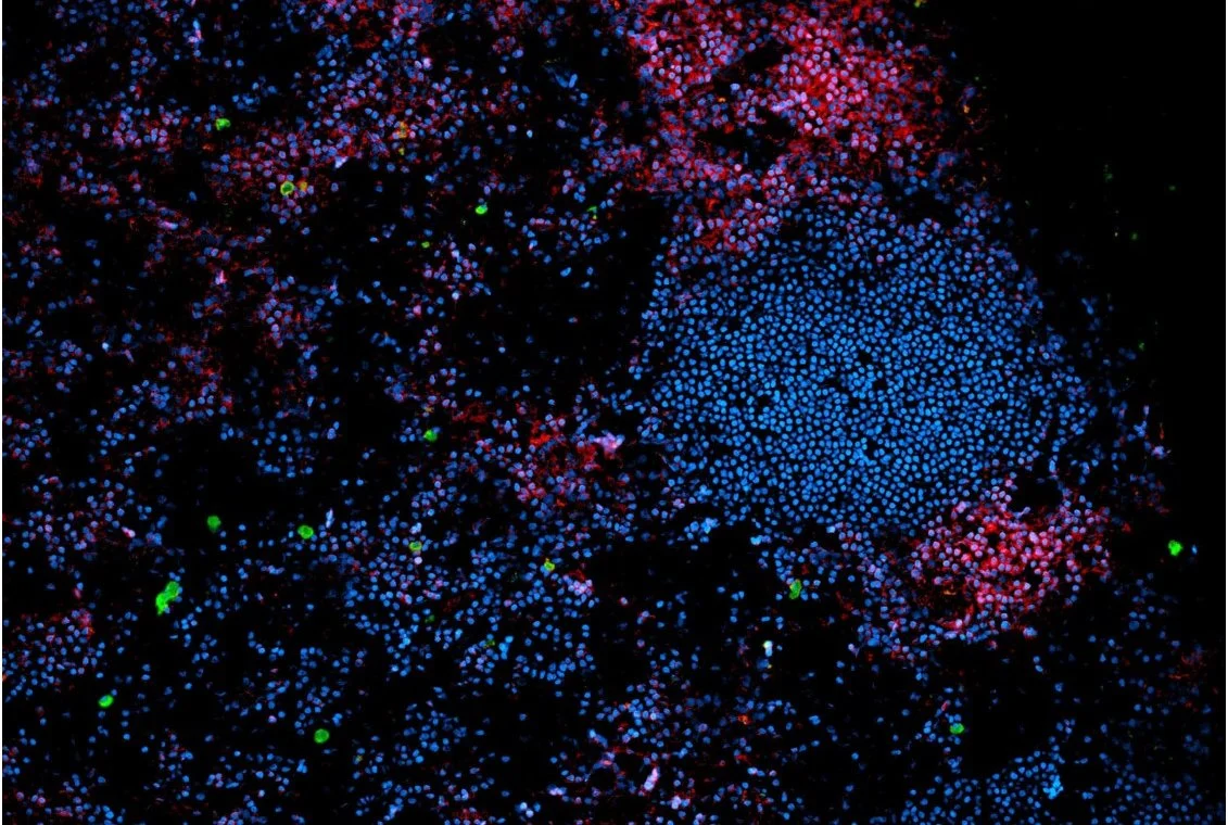 Micrografía de tejido de un ganglio linfático humano. En rojo se observan linfocitos T (marcador CD3) y en verde células linfoides innatas (ILC), un tipo de células inmunitarias clave en la regulación de la inflamación.