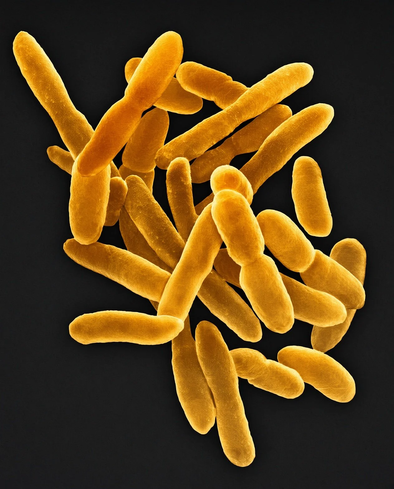 Imagen microscópica coloreada de bacterias del género Arthrobacter, un grupo presente en suelos de todo el mundo, aunque muchas de las cepas antárticas analizadas no se han encontrado en ningún otro lugar de la Tierra.