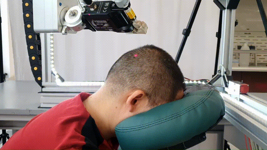 Impresión de los electrodos de tinta sobre el cuero cabelludo.