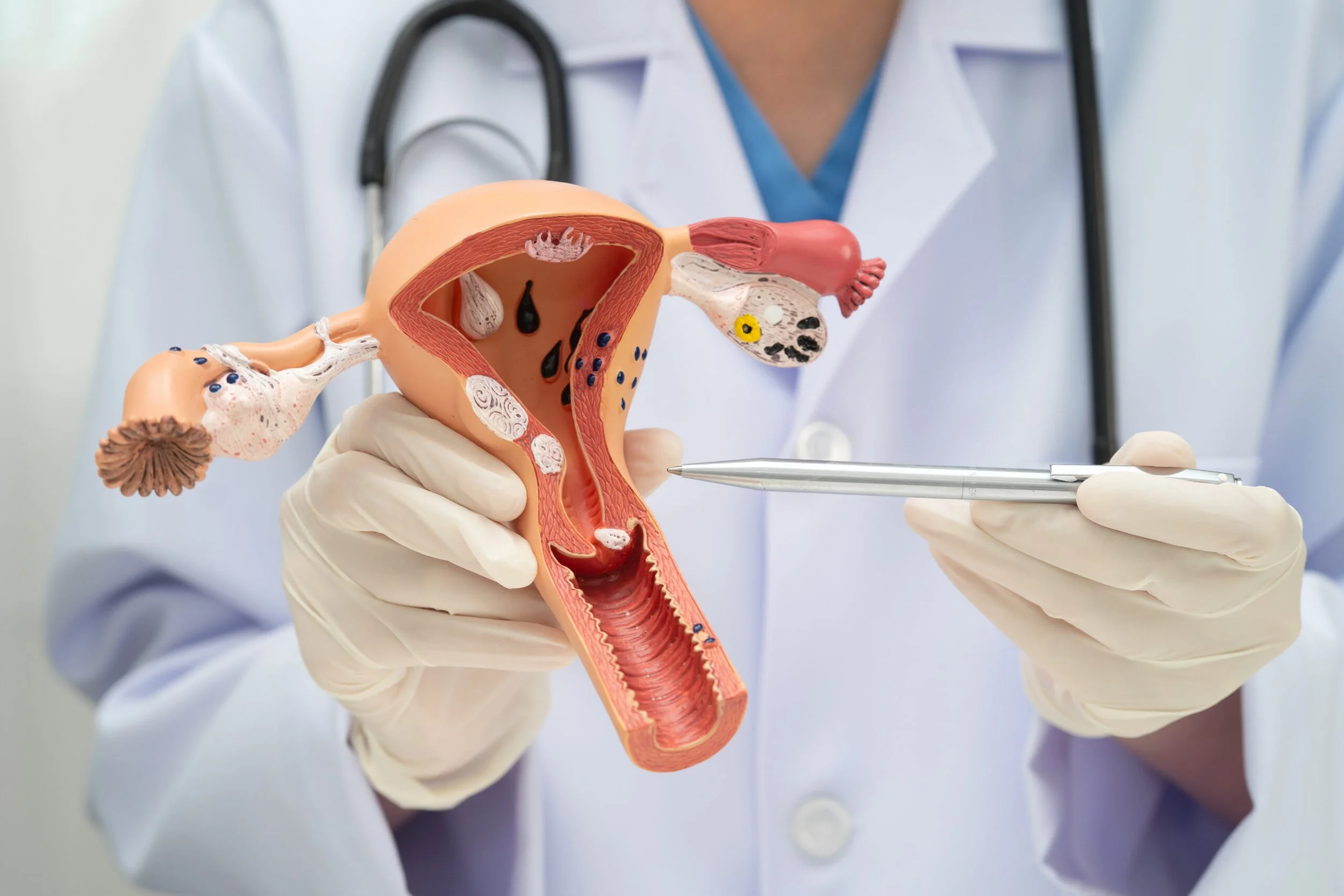 Una especialista muestra un modelo anatómico del aparato reproductor femenino, con el útero, las trompas de Falopio y los ovarios, cuyo envejecimiento influye directamente en la fertilidad.