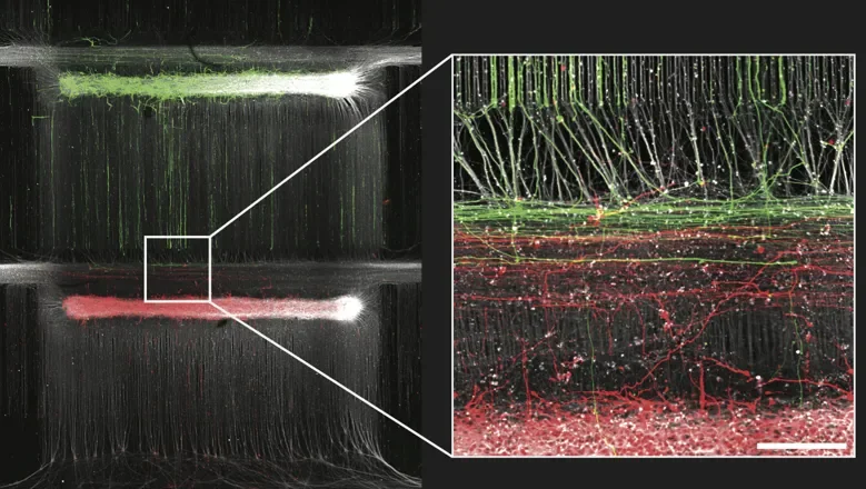 Tecnología BioConNet: neuronas rojas y verdes cultivadas establecen conexiones entre sí; en la imagen ampliada, la línea blanca indica una escala de 200 μm.