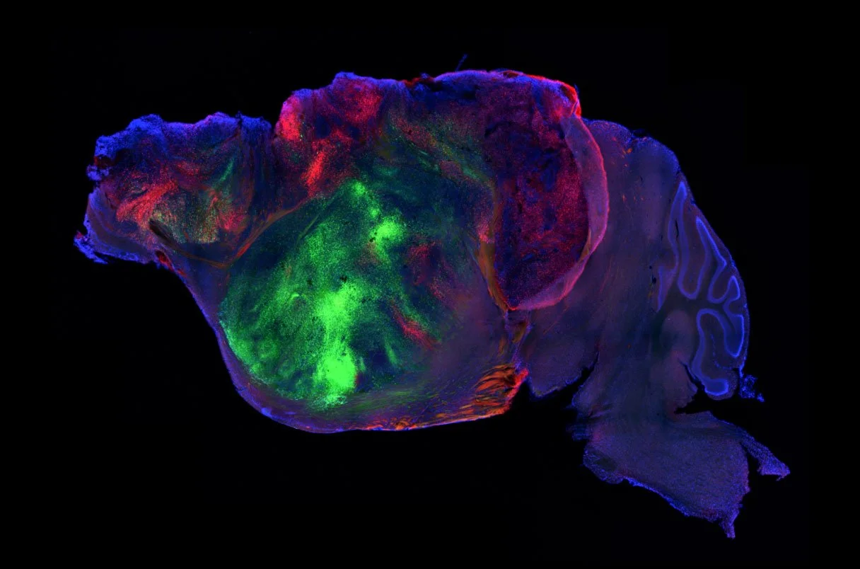 El tejido cerebral humano trasplantado, marcado en verde y rojo, creció dentro del cerebro del ratón —en azul— y extendió conexiones hacia diferentes circuitos de su sistema nervioso.