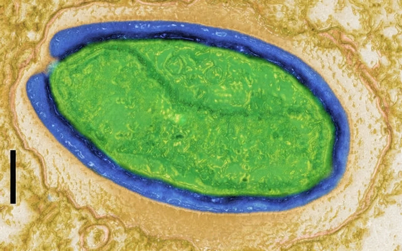 Pandoravirus quercus, observado al microscopio electrónico; la barra de escala equivale a 100 nanómetros.