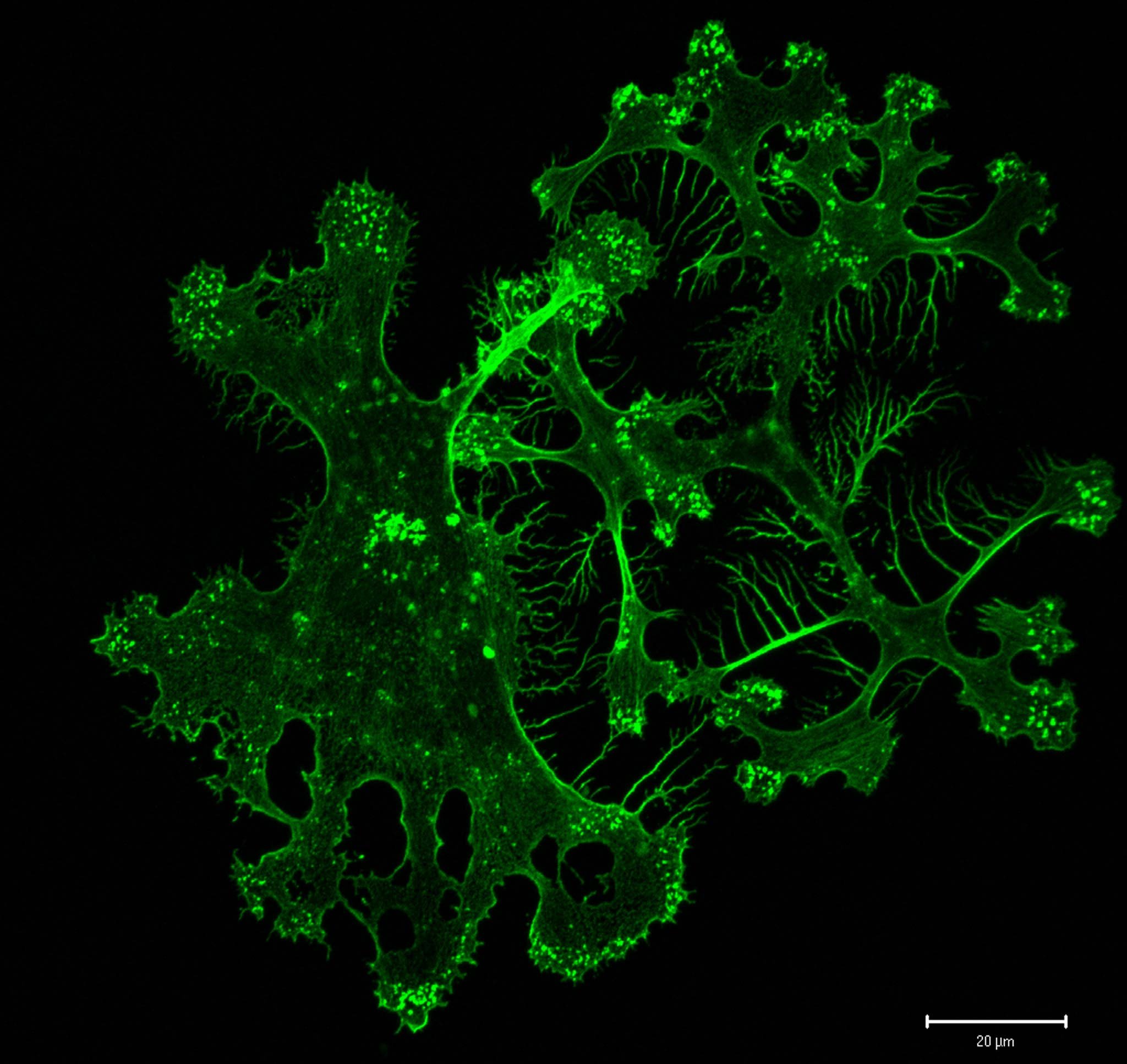 Imagen de una célula dendrítica humana, clave en la regulación del sistema inmunitario y protagonista de las nuevas terapias que buscan inducir tolerancia en el trasplante de hígado.