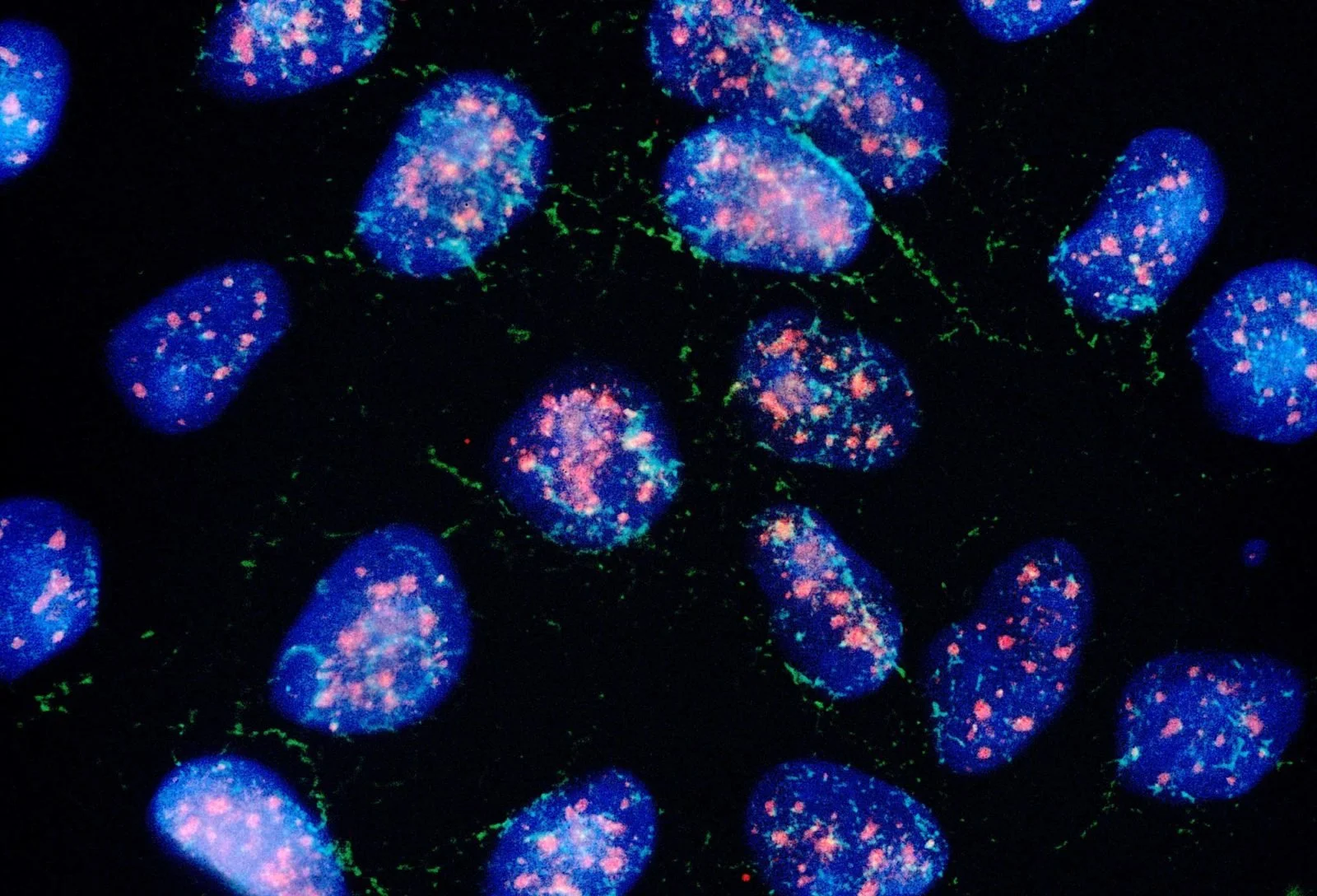 Células humanas de cáncer de pulmón observadas mediante microscopía de fluorescencia.