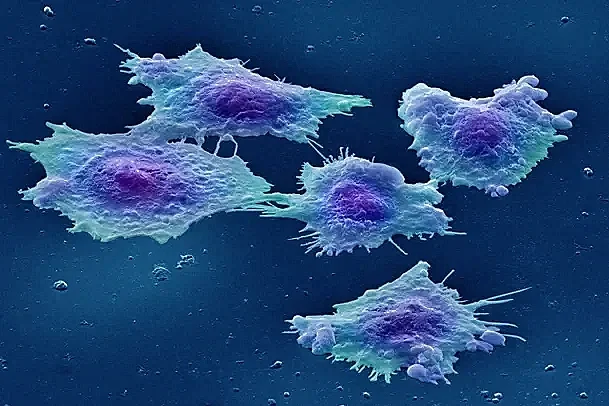 Imagen coloreada de células humanas de cáncer de colon en cultivo.