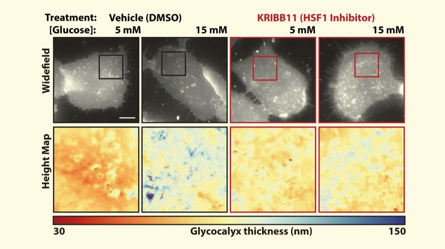 Imágenes obtenidas mediante microscopía de interferencia de barrido que muestran el grosor del glicocálix de células cultivadas con niveles normales (5 mM) y elevados (15 mM) de glucosa.