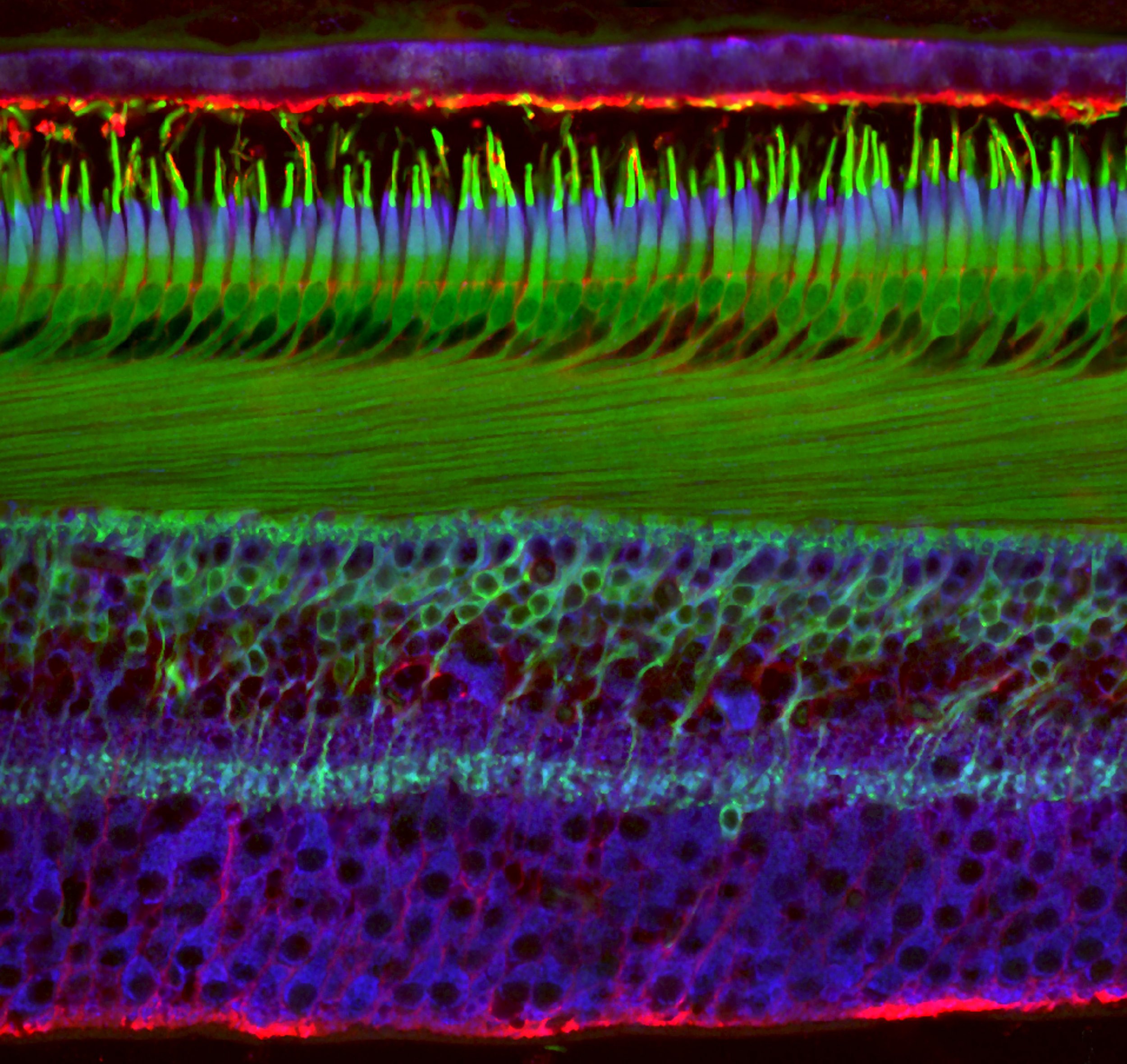 Micrografía de una retina humana donde se distinguen las distintas capas de tejido nervioso y los fotorreceptores (conos y bastones), las células encargadas de transformar la luz en impulsos eléctricos.