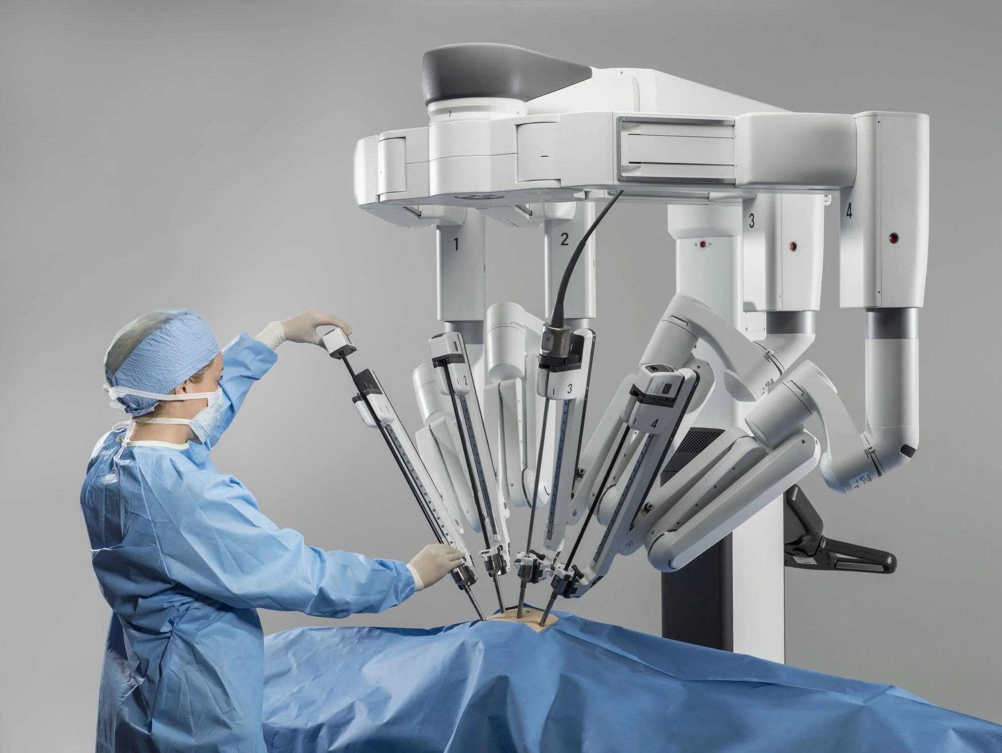 La cirugía robótica con el sistema Da Vinci permite realizar intervenciones de cáncer de próstata con gran precisión y menor invasividad.