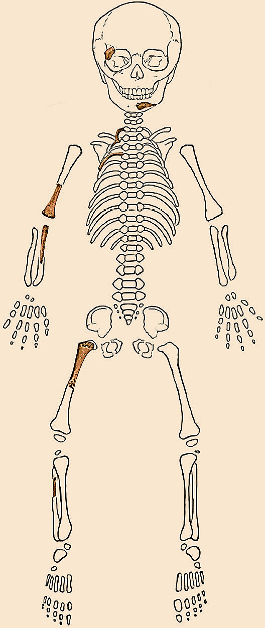 Reconstrucción de los restos óseos atribuidos a Sesselfelsgrotte 1, un neandertal que murió poco antes de nacer o en torno al momento del parto hace entre 50.000 y 75.000 años.
