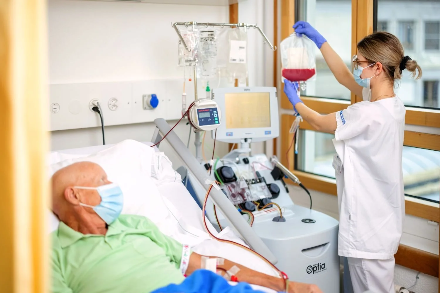 Un paciente recibe un procedimiento de extracción o trasplante de células madre hematopoyéticas, una terapia fundamental en el tratamiento de leucemias y otros cánceres de la sangre.