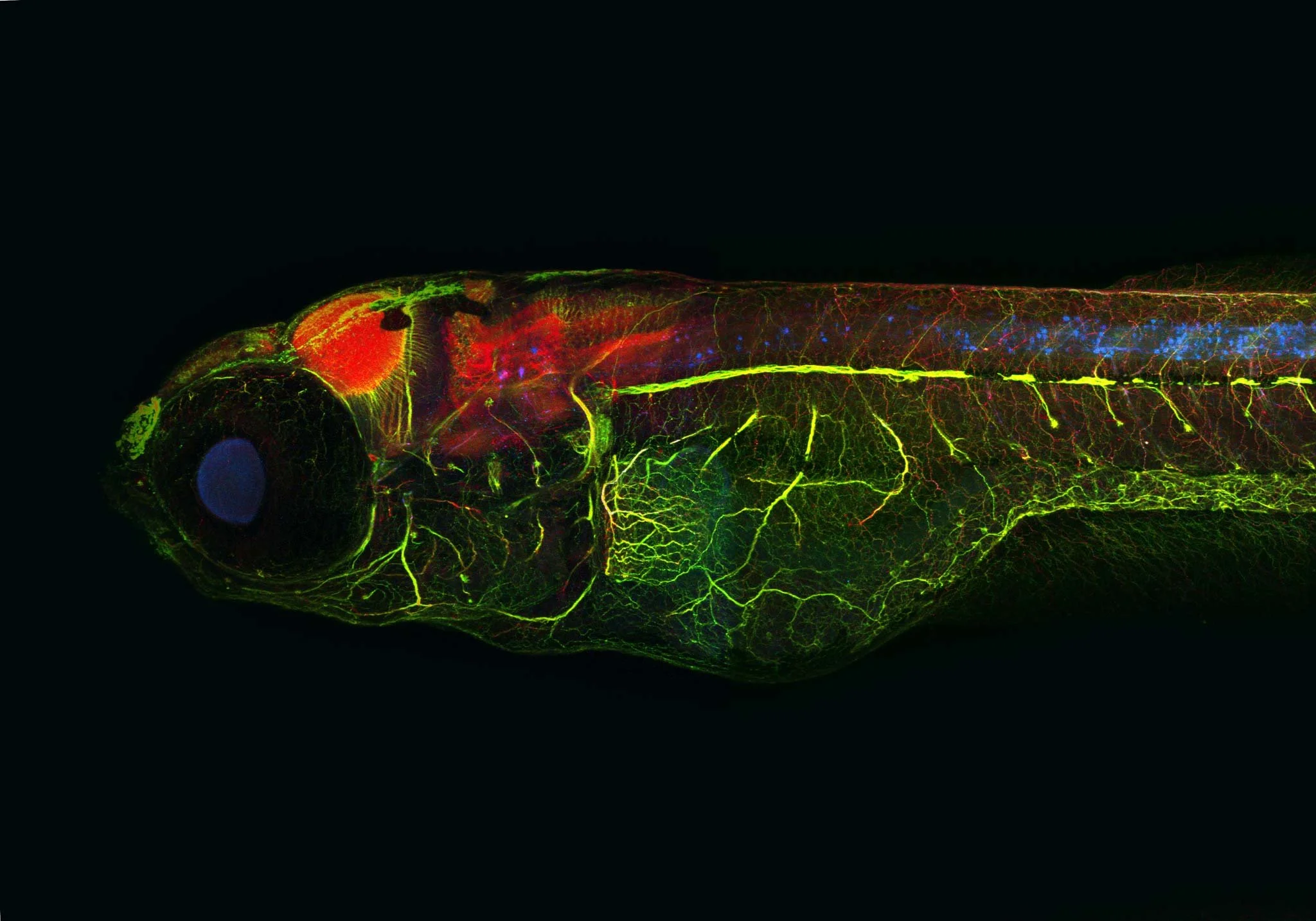 Imagen de pez cebra utilizado como modelo del alzhéimer, donde se observan en rojo la proteína tau; en verde, las neuronas; y en azul, las formas patológicas de tau asociadas a la enfermedad.