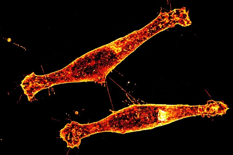Nanotúneles celulares que conectan neuronas con expresión de Rhes, una proteína implicada en la propagación de la enfermedad de Huntington.